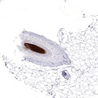 Anti-KRTAP2-4 Antibody