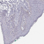 Anti-KRTAP2-4 Antibody