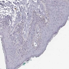 Immunohistochemical staining of human skin shows no cytoplasmic positivity in squamous epithelial cells as expected.