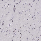 Immunohistochemical staining of human cerebral cortex shows no cytoplasmic positivity in neuronal cells as expected.