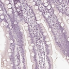 Immunohistochemical staining of human small intestine shows no cytoplasmic positivity in glandular cells as expected.