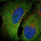 Anti-PRELP Antibody