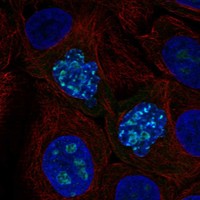 Anti-ZNF202 Antibody