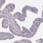 Immunohistochemical staining of human fallopian tube shows weak nuclear positivity in glandular cells.