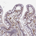 Immunohistochemical staining of human duodenum shows moderate nuclear positivity in glandular and stromal cells.