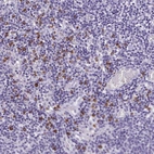 Anti-PSD Antibody