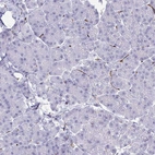 Immunohistochemical staining of human pancreas shows no positivity in exocrine glandular cells as expected.
