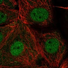 Immunofluorescent staining of human cell line MCF7 shows localization to nucleoplasm.