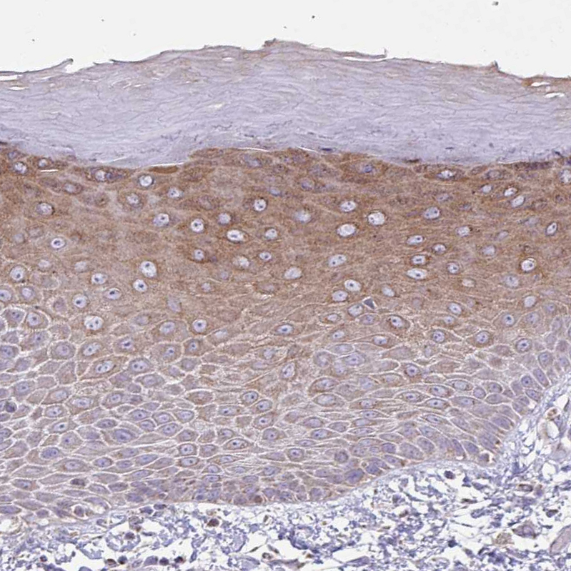 Anti-ZNF362 Antibody