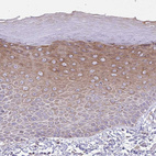 Anti-ZNF362 Antibody
