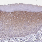 Anti-ZNF362 Antibody