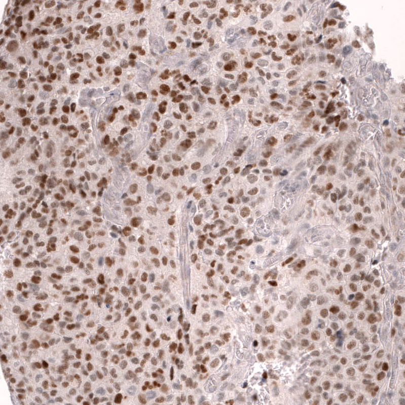 Anti-FOXO3 Antibody