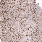 Anti-FOXO3 Antibody