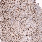 Anti-FOXO3 Antibody