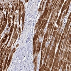 Immunohistochemical staining of human heart muscle shows strong cytoplasmic positivity in cardiomyocytes.