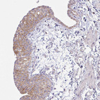 Anti-NDUFA7 Antibody