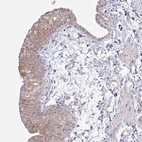 Immunohistochemical staining of human fallopian tube shows moderate cytoplasmic positivity in glandular cells.