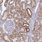Immunohistochemical staining of human kidney shows moderate cytoplasmic positivity in cells in tubules.