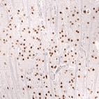 Immunohistochemical staining of human cerebral cortex shows strong nuclear positivity in neurons.