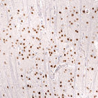 Anti-FOXO3 Antibody