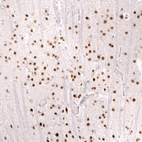 Immunohistochemical staining of human cerebral cortex shows strong nuclear positivity in neurons.