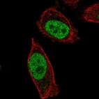Immunofluorescent staining of human cell line PC-3 shows localization to nucleoplasm.