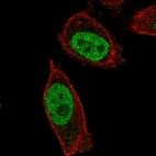 Immunofluorescent staining of human cell line PC-3 shows localization to nucleoplasm.