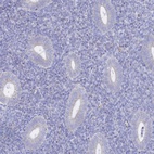 Immunohistochemical staining of human endometrium shows low expression as expected.