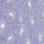 Immunohistochemical staining of human endometrium shows low expression as expected.