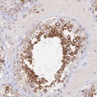 Immunohistochemical staining of human testis shows high expression.