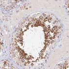 Immunohistochemical staining of human testis shows high expression.