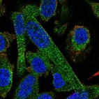 Anti-PPP2R5A Antibody