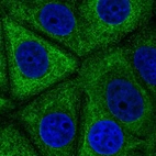 Immunofluorescent staining of human cell line MCF7 shows localization to cytosol.