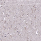 Immunohistochemical staining of human hippocampus shows vesicular positivity in neurons.