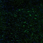 Immunofluorescence staining of mouse pons shows cytoplasmic staining in the vestibular nucleus.