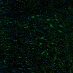Immunofluorescence staining of mouse pons shows cytoplasmic staining in the vestibular nucleus.