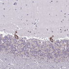 Anti-DTX4 Antibody