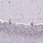 Immunohistochemical staining of human cerebellum shows strong granular cytoplasmic immunoreactivity in Purkinje cells.
