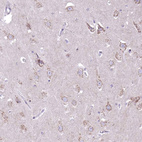 Anti-DTX4 Antibody