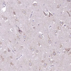 Immunohistochemical staining of human hippocampus shows moderate granular immunoreactivity in neuronal cell bodies.