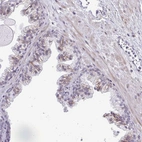 Immunohistochemical staining of human prostate shows moderate cytoplasmic positivity in glandular cells.