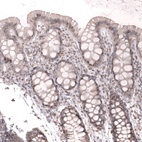 Immunohistochemical staining of human gastrointestinal shows weak to moderate nuclear positivity in glandular cells.