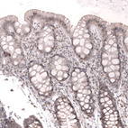 Anti-FOXO3 Antibody