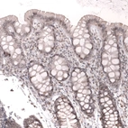 Immunohistochemical staining of human gastrointestinal shows weak to moderate nuclear positivity in glandular cells.