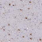 Anti-ASPH Antibody