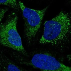 Anti-TTLL7 Antibody