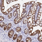 Immunohistochemical staining of human small intestine shows strong cytoplasmic positivity in glandular cells.