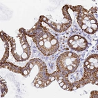 Immunohistochemical staining of human colon shows moderate to strong cytoplasmic positivity in glandular cells.