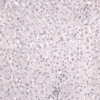 Immunohistochemical staining of human liver shows no nuclear positivity in hepatocytes as expected.
