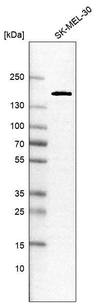 Anti-DIP2C Antibody